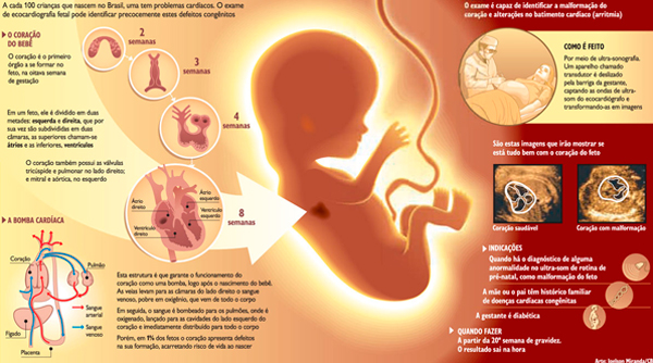 Ecocardiograma Fetal Prevê Doenças Cardíacas No Bebê Instituto Furlanetto 